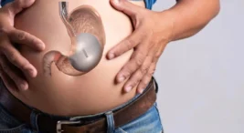 2026 Mide Botoksu Zararları ve Fiyatı: Riskler, Yan Etkiler ve Maliyet Analizi