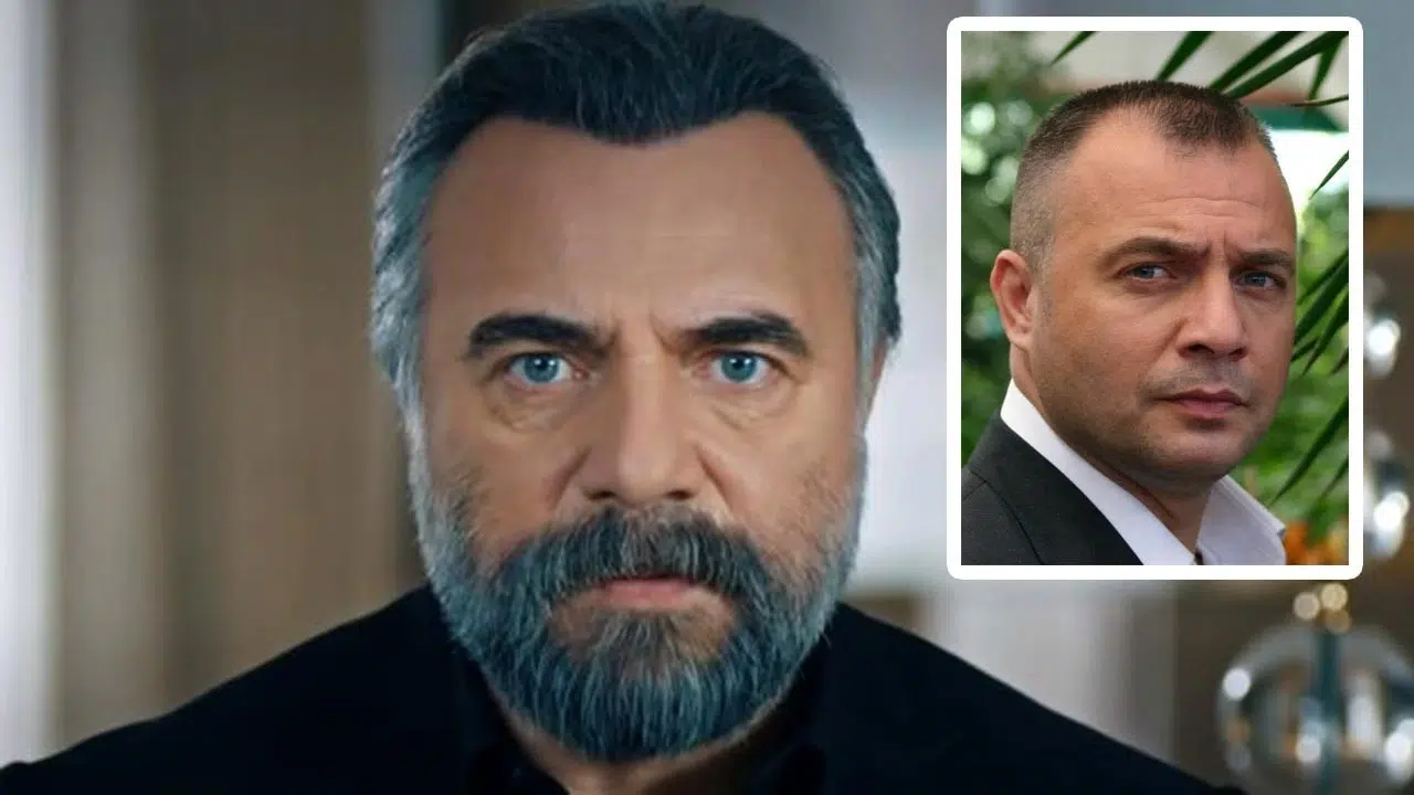 Sakal Ekimi Yaptıran Türk Ünlüler: Köse Olan İsimlerin İnanılmaz Değişimi