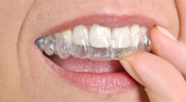 Diş Teli Yerine Şeffaf Plak Kullanan Ünlüler (Invisalign) : Tedavi Maliyetleri Ne Kadar?