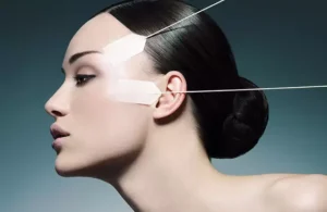 5 Sırrıyla Ameliyatsız Yüz Germe: Fransız Askısı Yaptıran Ünlüler