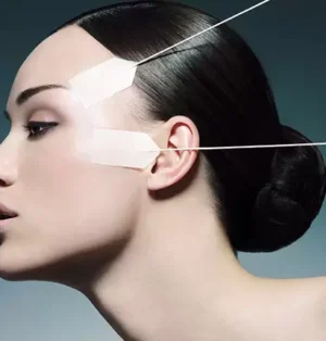 5 Sırrıyla Ameliyatsız Yüz Germe: Fransız Askısı Yaptıran Ünlüler