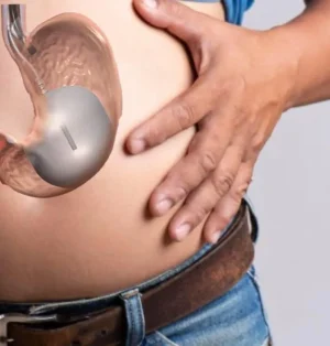 5 Sırrıyla Mide Botoksu Yaptıranların Yorumları ve 2026 Fiyatları